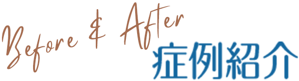 症例紹介